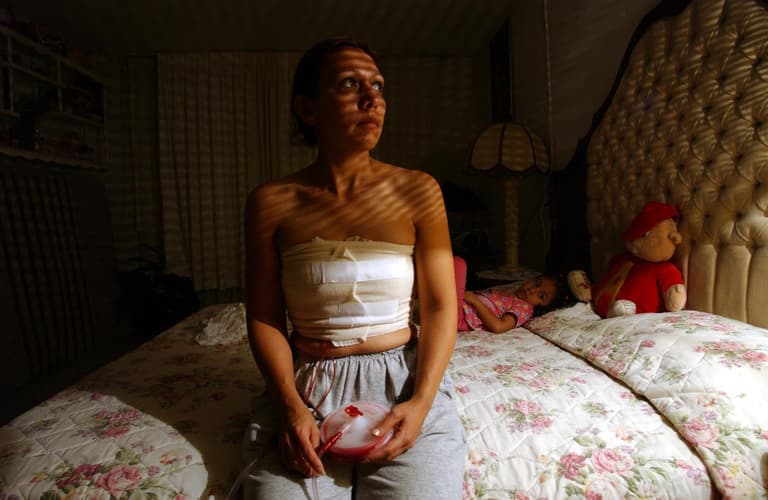 Twenty women had unnecessary mastectomies, County Durham NHS trust admits Twenty women had unnecessary mastectomies, County Durham NHS trust admits