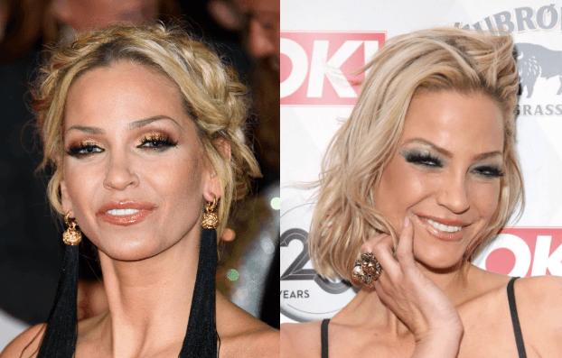 Sarah Harding’s ‘tumours shrink’ after cancer treatment
