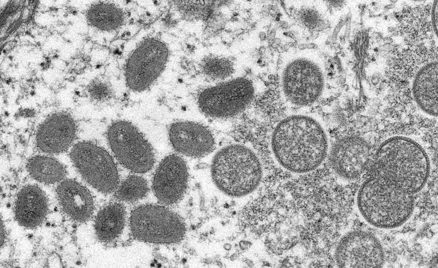 Monkeypox contacts advised to isolate for 21 days, UKHSA says