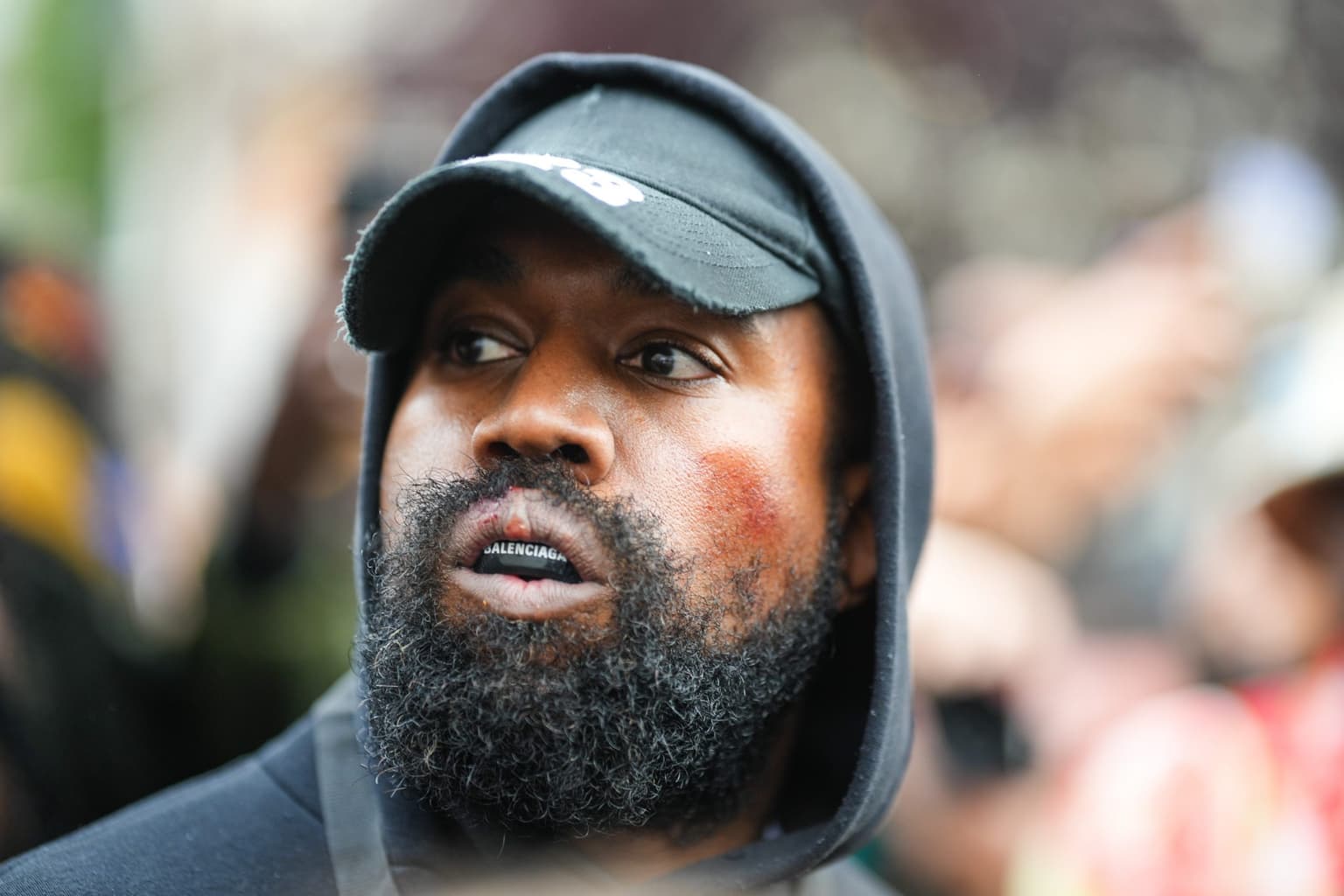 Kanye West kicked out of Skechers office day after Adidas ditched him
