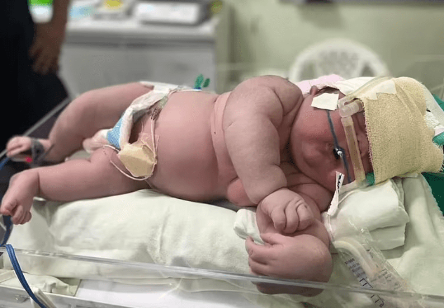 Mum gives birth to 2ft tall baby weighing a huge 16lbs