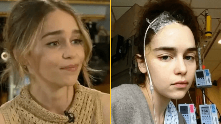 Emilia Clarke missing ‘quite a bit’ of her brain after two aneurysms and is ‘surprised’ she can speak Emilia Clarke missing ‘quite a bit’ of her brain after two aneurysms and is ‘surprised’ she can speak