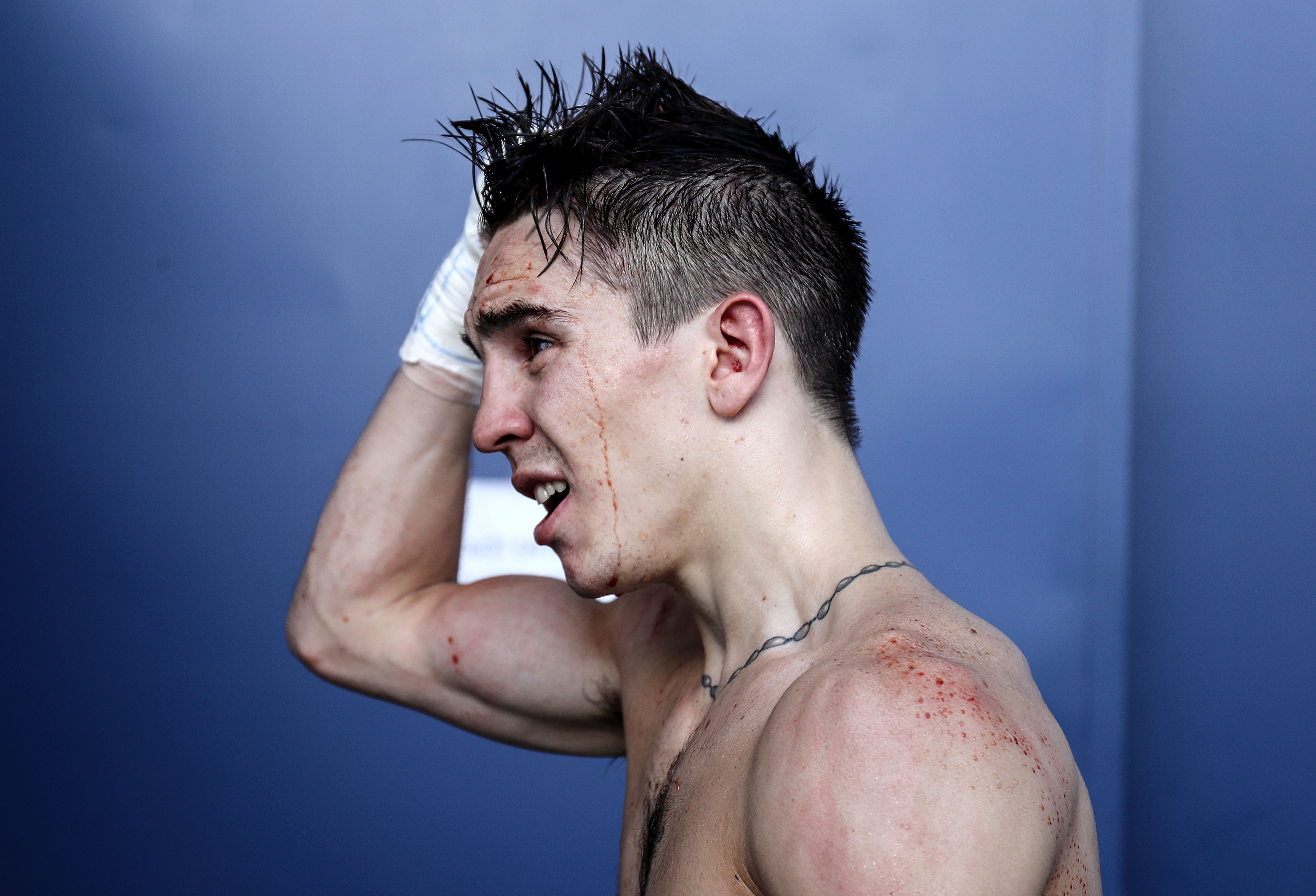 Michael Conlan S Latest Claims About Corruption In Amateur Boxing Are