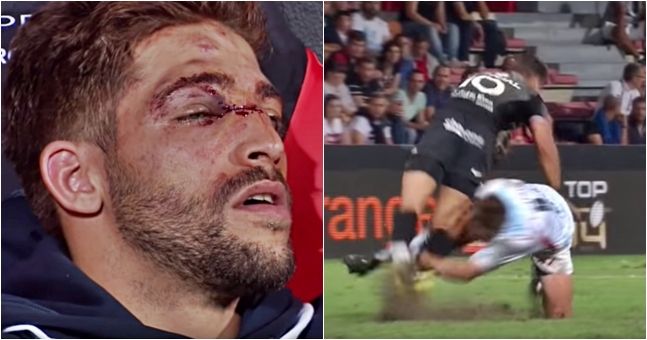rugby face injuries
