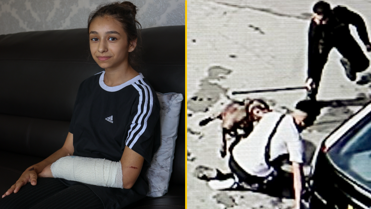 Girl, 11, Attacked By XL Bully In Birmingham Says The Dog Should Be Put ...